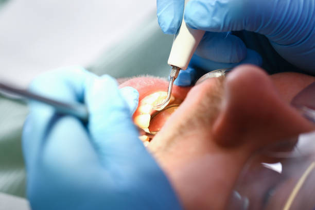Best Emergency Dental Care for Broken or Chipped Teeth in Hudson, WI